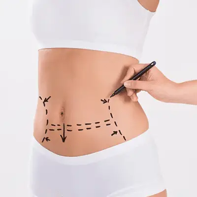 Aesthetic and Cosmetic Treatments 6 Body Lift in Turkey
