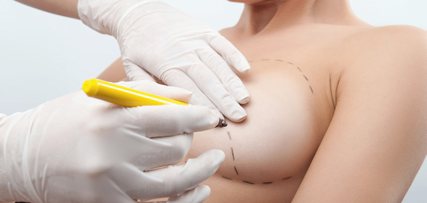 Nipple Reduction Surgery Turkey