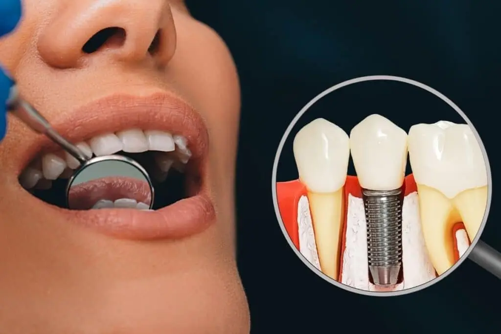 Dеntаl Іmрlаntѕ & Dental Clinic 269 Dental Implants