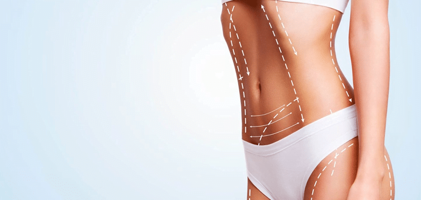 Vaser Liposuction in Turkey