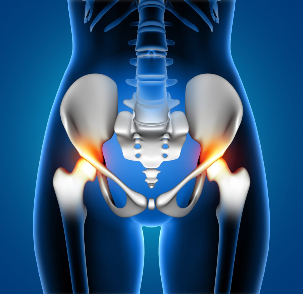 Hip Replacement Surgery in Antalya: 5 Best Safe Benefits 3 hip replacement surgery antalya