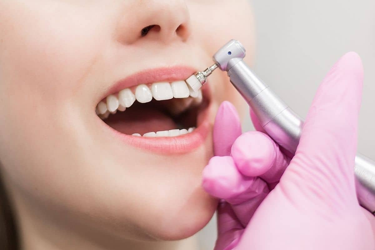 Teeth Whitening in Turkey Cayra Clinic