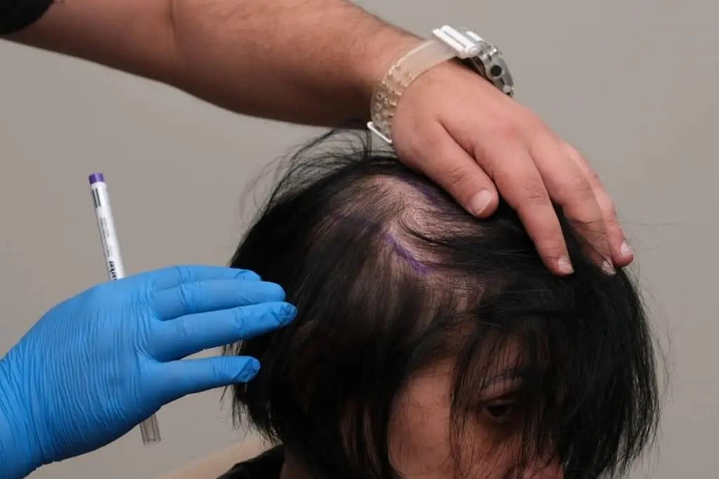 Hair Analysis 2 cvc