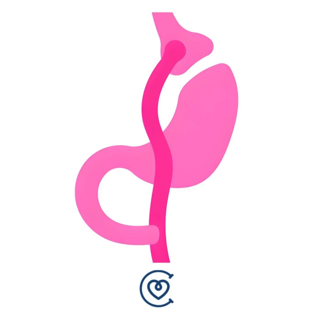 Gastric Bypass Treatment