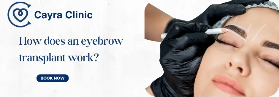 How does an eyebrow transplant work