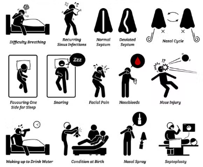 Symptoms of a Deviated Septum