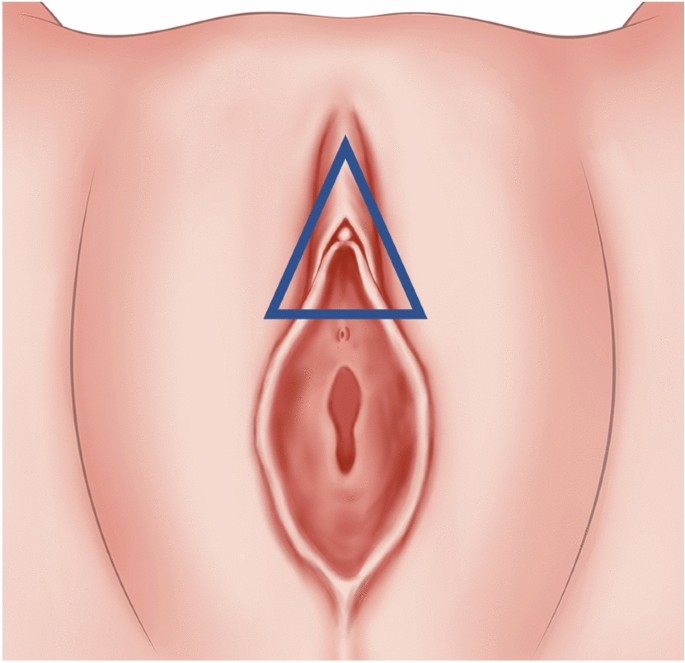Clitoral Hood Reduction Treatment