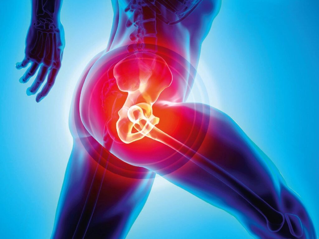 Risks and Complications of Hip