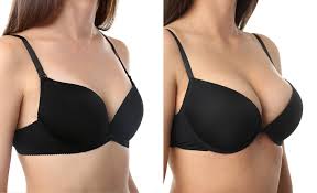 Celebrities with Breast Implants