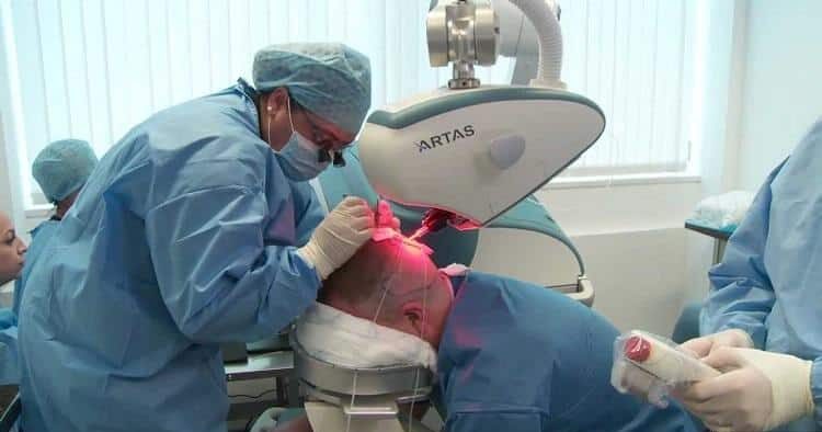 How Robotic Hair Transplant works