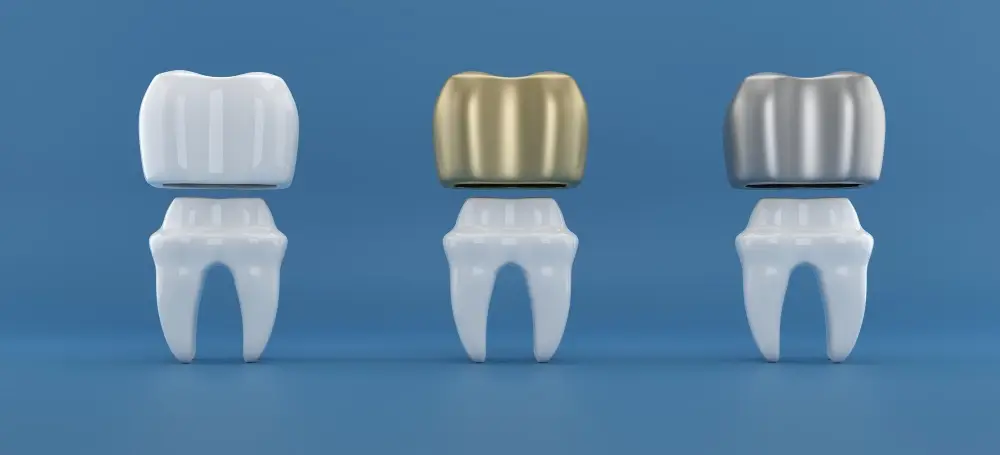 Best Dental Clinic in Turkey, Affordable Prices, Natural Results, Lifelong Guarantee 1 Dental Crowns