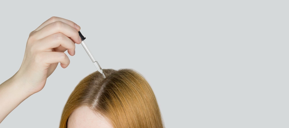 Hair Mezotherapy for hair loss