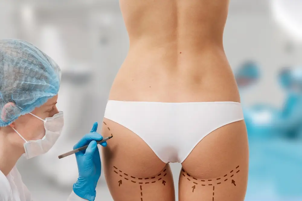 Butt & Hip Fillers in Turkey | Non-Surgical Enhancement 204 Hip Dips Correction | Fillers in Turkey