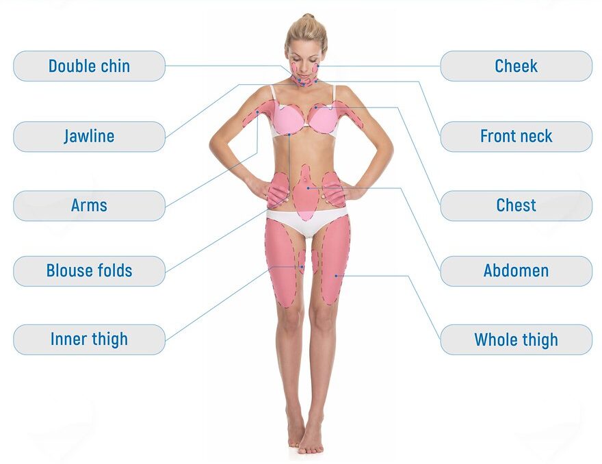 Liposuction Areas