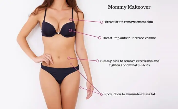 Body Lifting 6 Mommy Makeover Photo