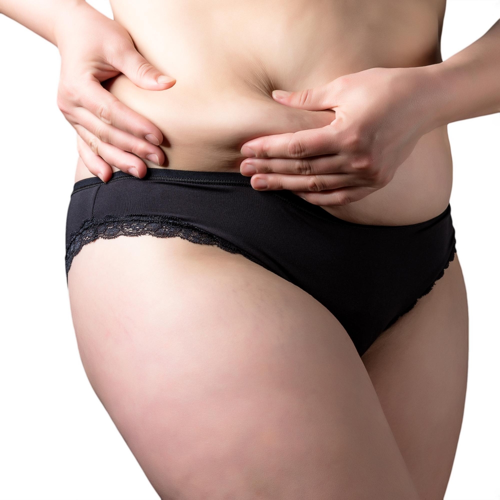 Stomach Liposuction