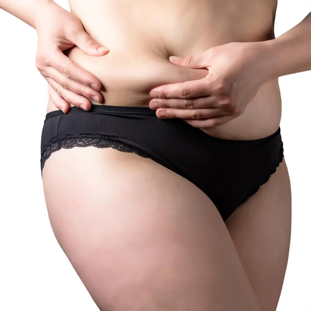 Liposuction Turkey | Remove Fat & Sculpt Your Body 3 Stomach Liposuction