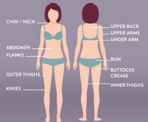 types of vaser liposuction