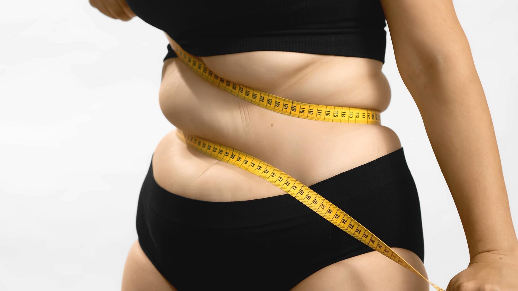 Liposuction Before and After
