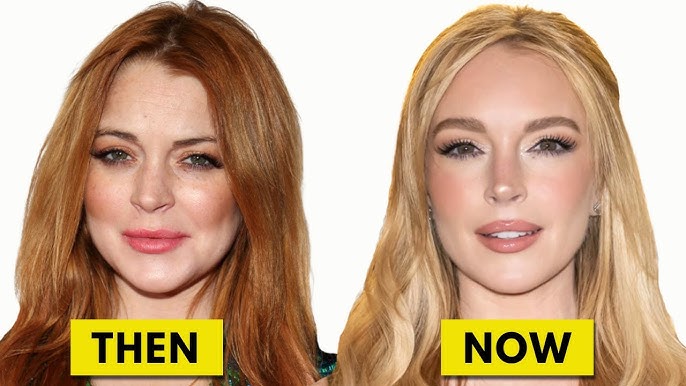 Lindsay Lohan Plastic Surgery Transformation 3 Linday Lohan before after photo