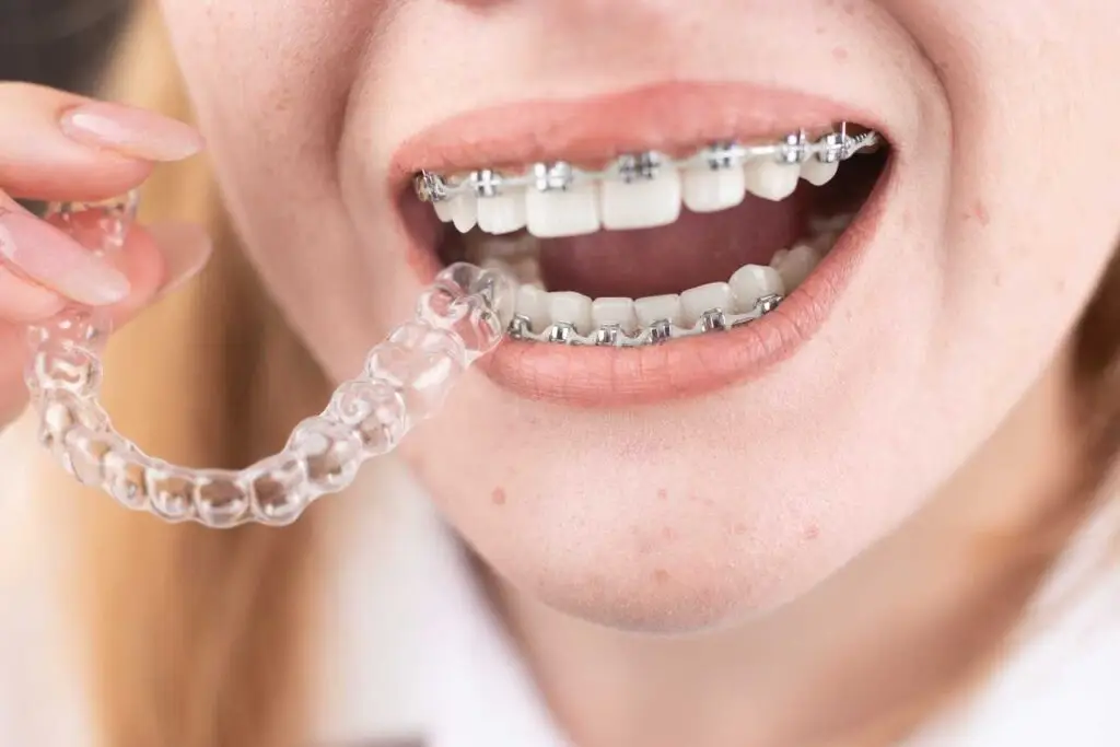 Orthodontic Treatment Cost Comparison 2025 140 Orthodontic Treatment Cost
