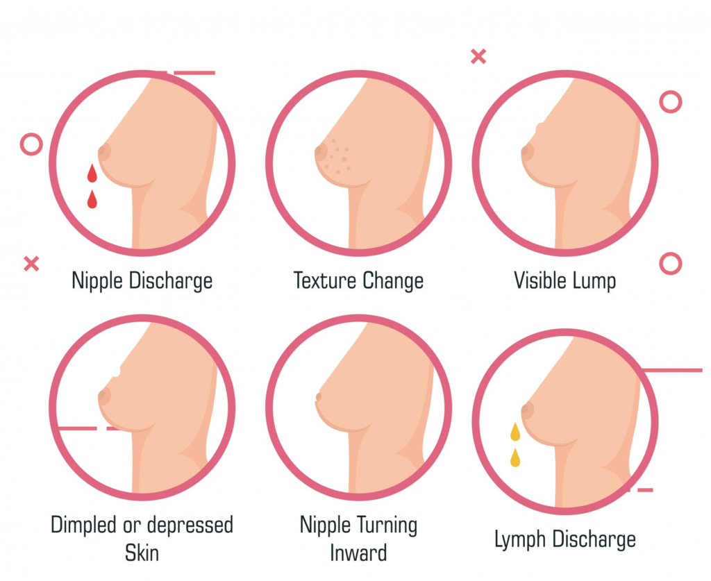 Causes of Tuberous Breast
