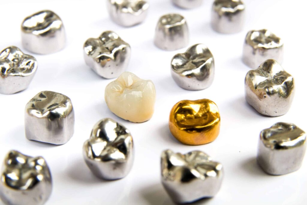 Gold Teeth: Benefits, Types & Cost in Antalya, Turkey 3 Types of Gold Dental Treatments