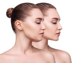 Maintaining Your Neck Liposuction Results
