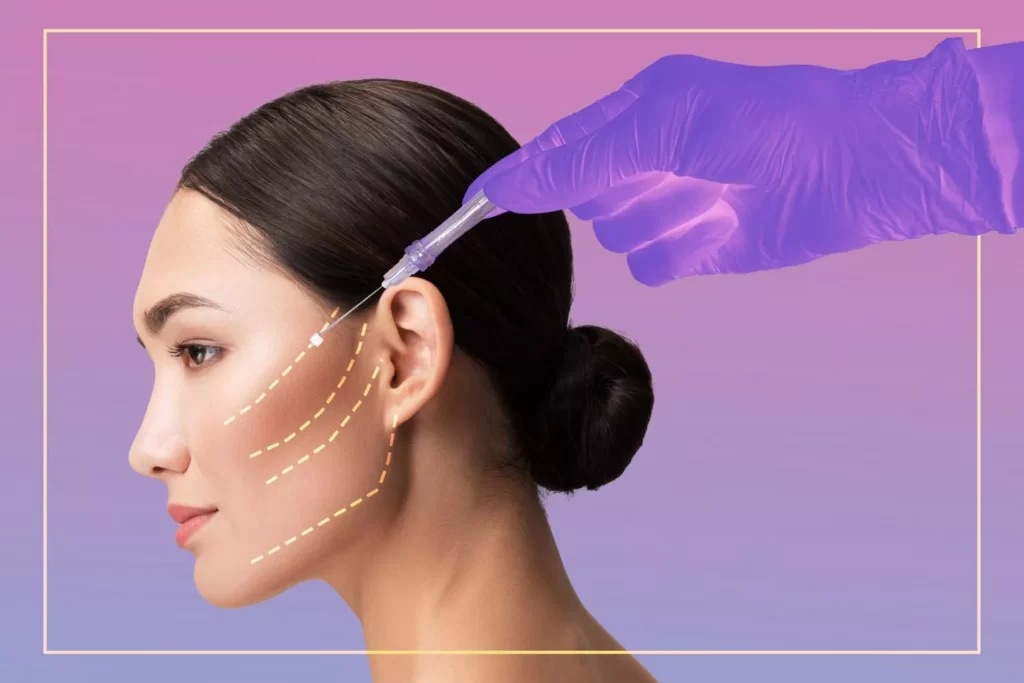 Thread Lifting Surgery