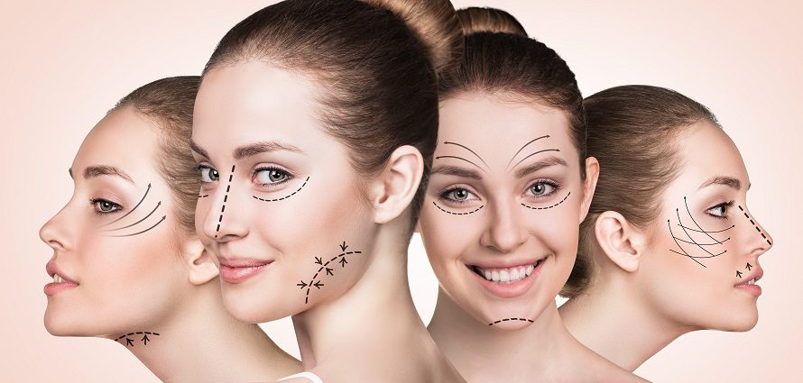 Endoscopic facelift procedure