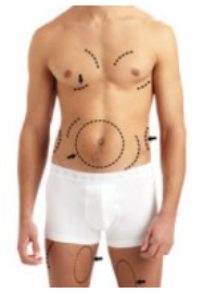 Areas That Can Be Treated with Cryolipolysis-men