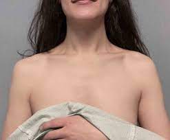 Clavicle Shortening Surgery, Clavicle Shortening Surgery Complications