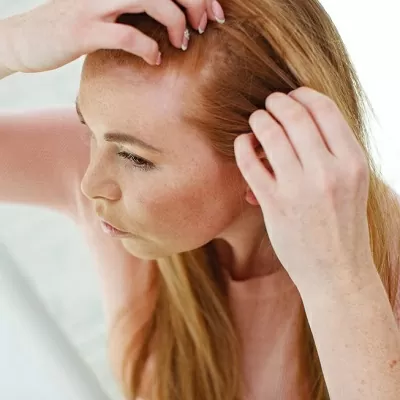 Female hair transplant