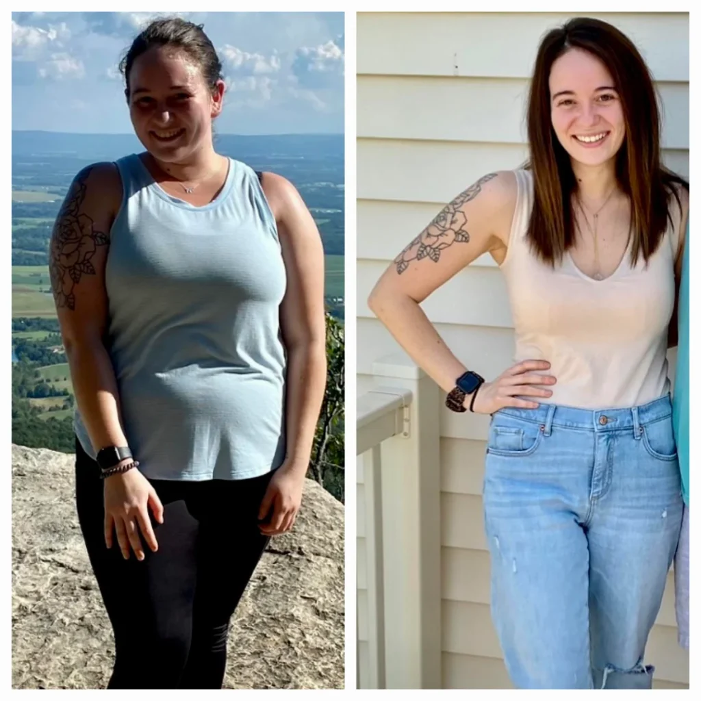 Ozempic Weight Loss Before & After