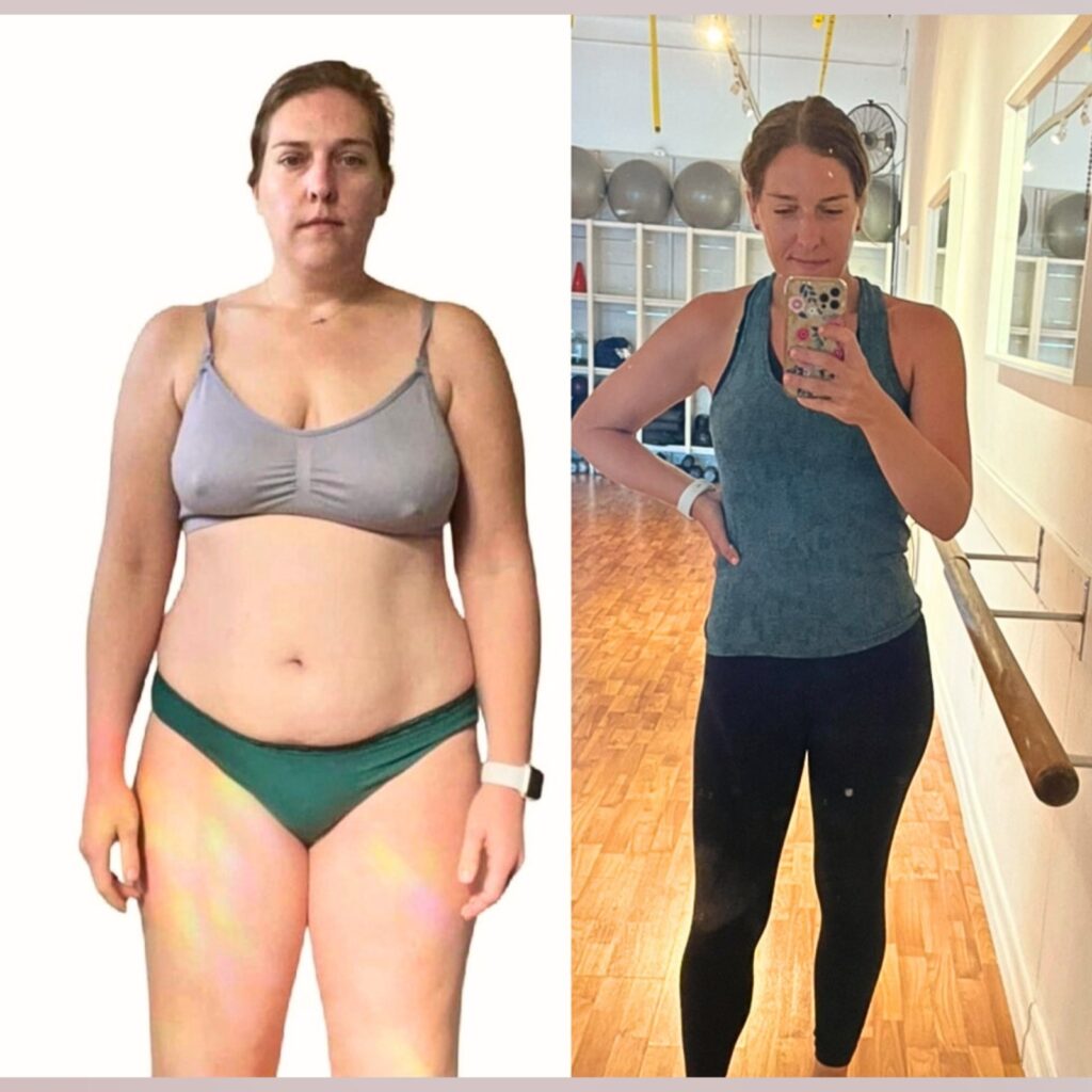 Ozempic Weight Loss Before and After