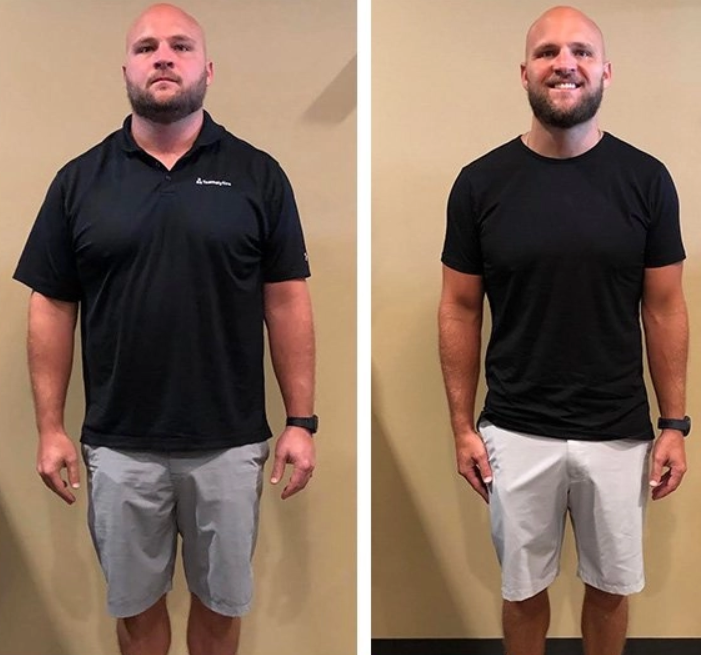 Real Results - Ozempic Weight Loss Before and After