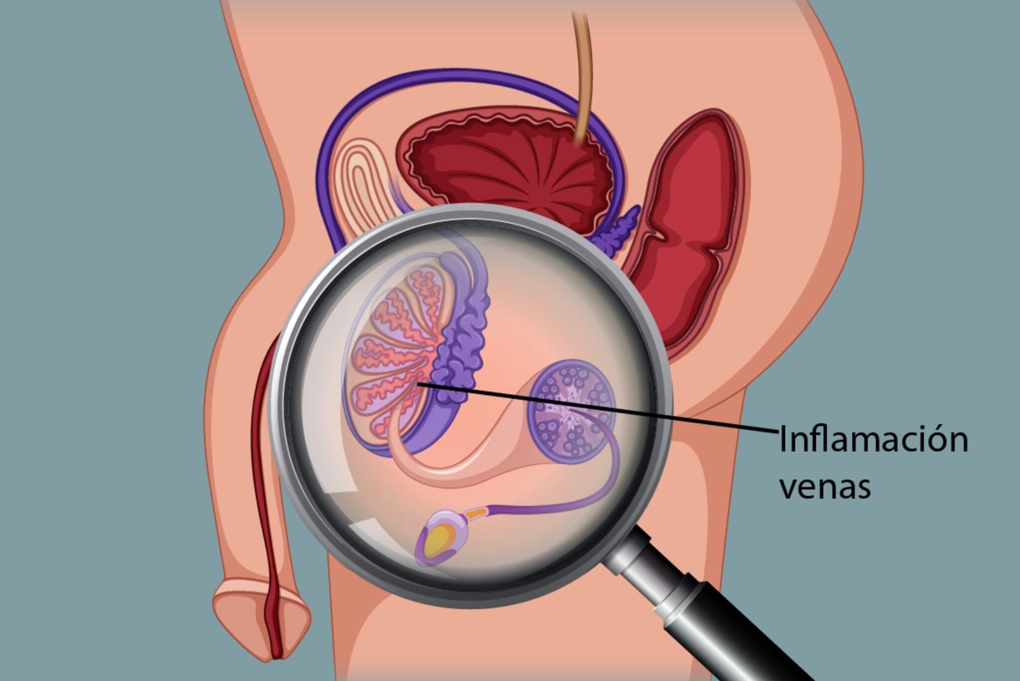 Varicocele Microsurgery Success Rate