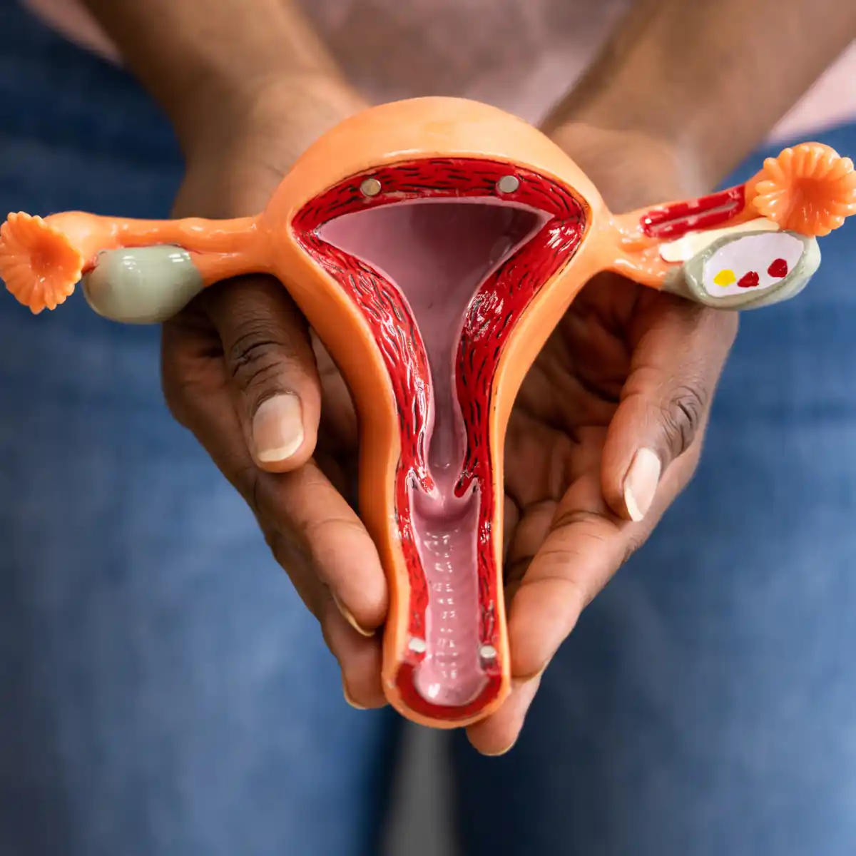 Vaginal Prolapse