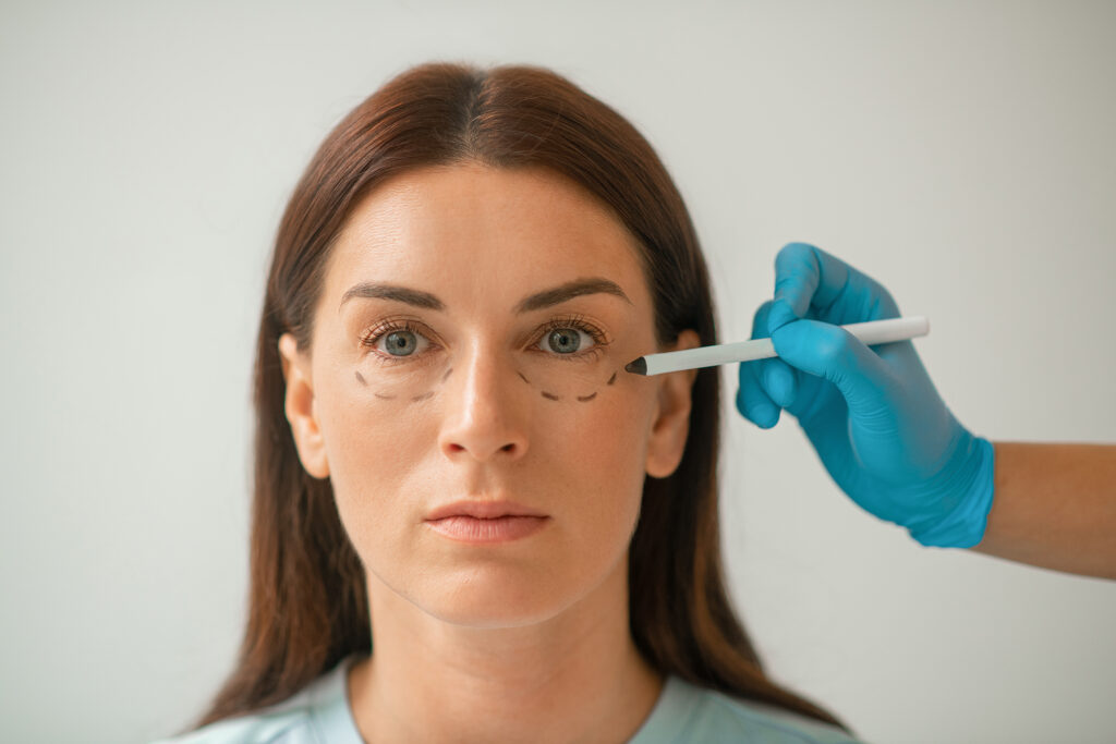 Procedure for Blepharoplasty treatment