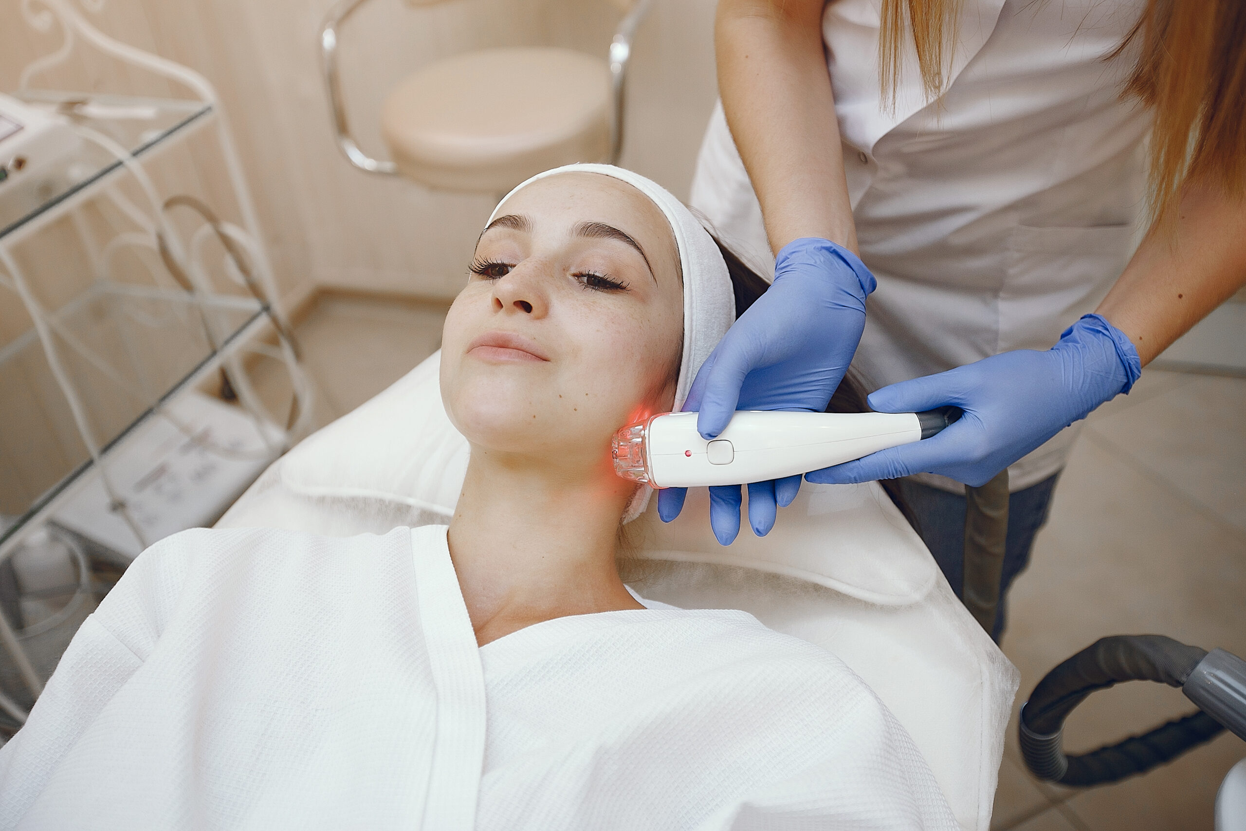 Laser Treatment for Acne Scars