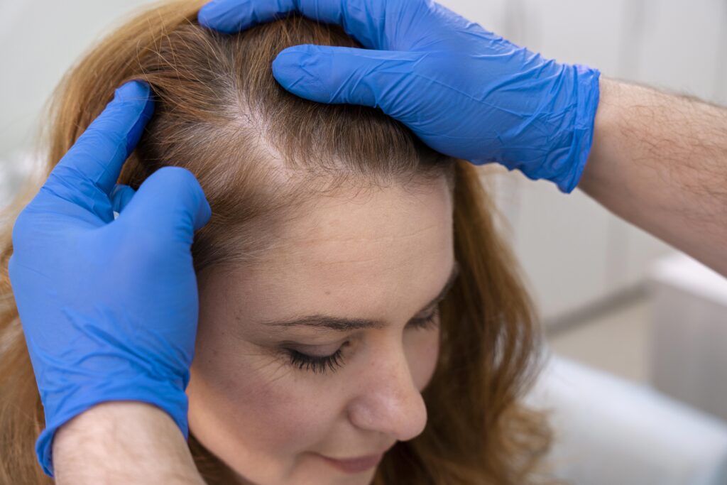 scalp micro pigmentation process