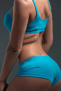 PMMA Buttock Fillers