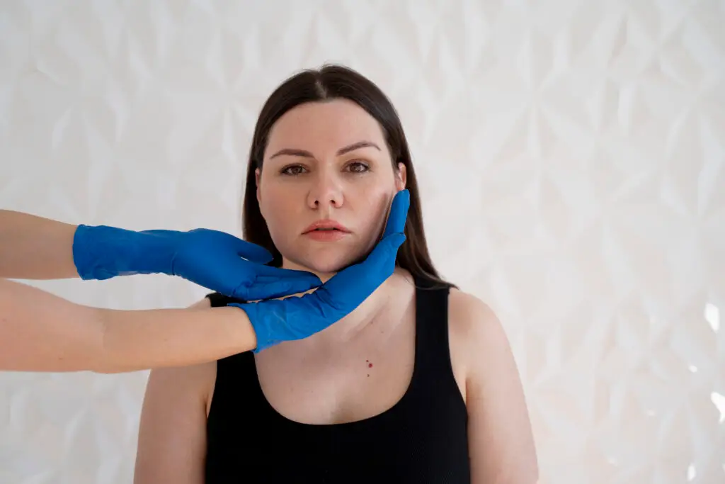 Vampire Facelift in Turkey 2026 : Rejuvenate Your Skin Naturally at Cayra Clinic 109 Vampire Facelift