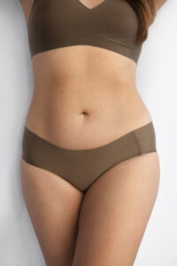 FUPA Surgery in Turkey 2025 – Fat Upper Pelvic Area Liposuction & Lifting at Cayra Clinic 3 FUPA Surgery in Turkey