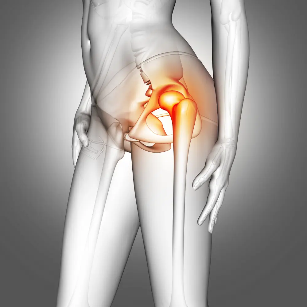 Cheap hip replacement cost