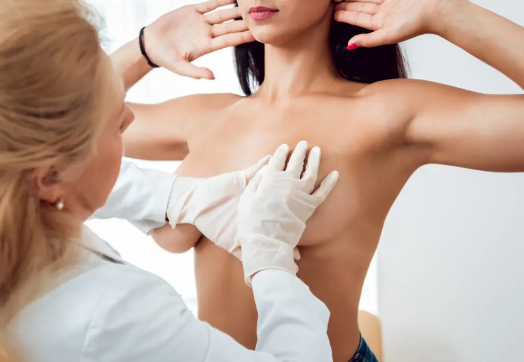 vampire breast lift procedure