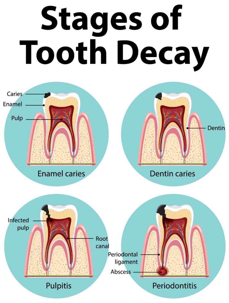 Gum Disease 1 gum-disease