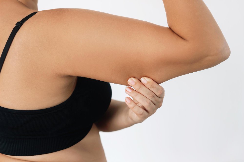 Arm Liposuction in Turkey