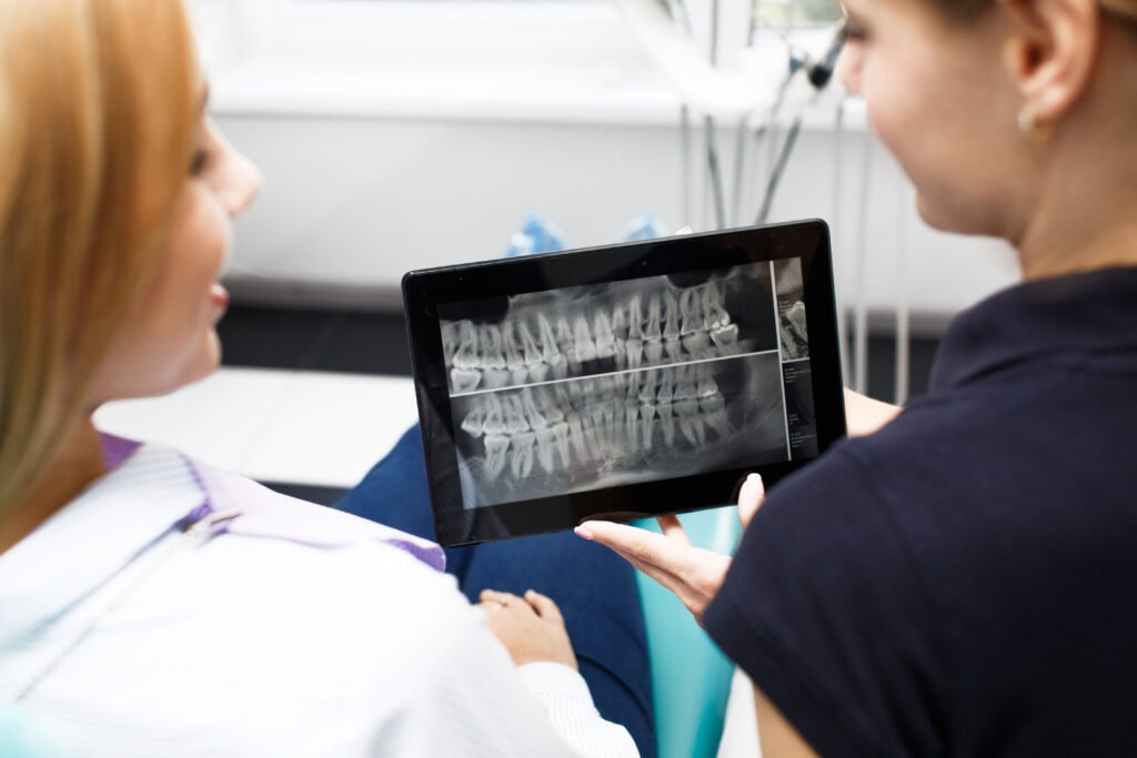 Failed All-on-4 Implants From Another Clinic: Can They Be Fixed in Turkey? 1 Dentist examining three-dimensional x-ray of problematic dental implants