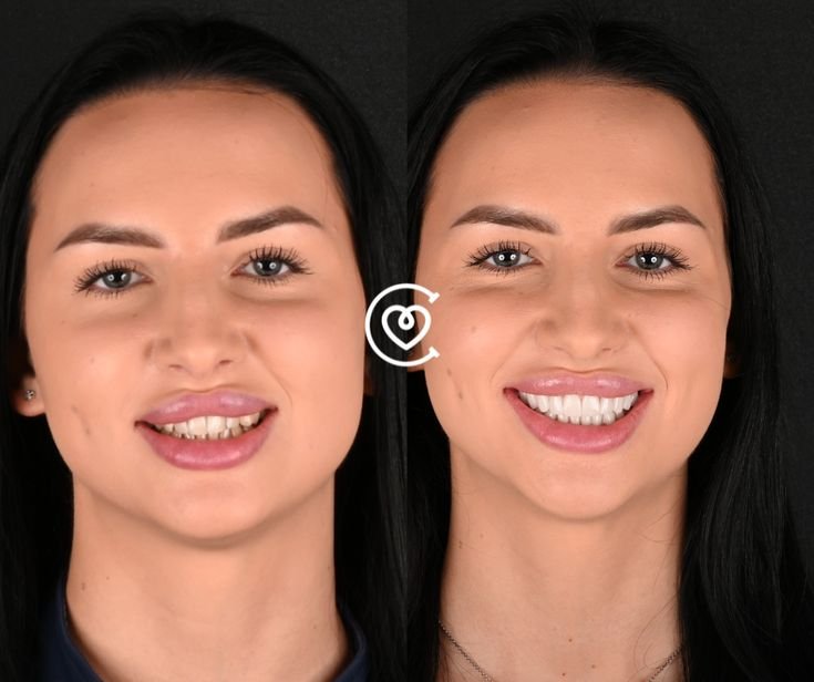 Advanced digital smile design and 3D CAD/CAM technology used in elite dental clinics in Turkey